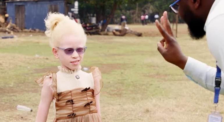 Dia Internacional para Conscientização do Albinismo foca em prevenção do câncer