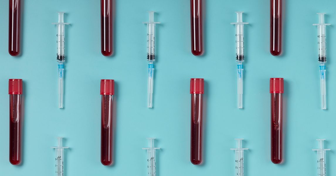 Blood Feud: painéis de saúde de Oura versus laboratórios avançados de Whoop