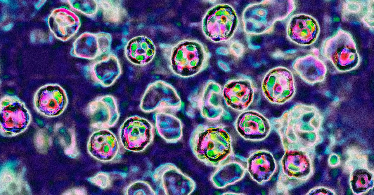 Os EUA enfrentam outro ano ruim de casos de sarampo