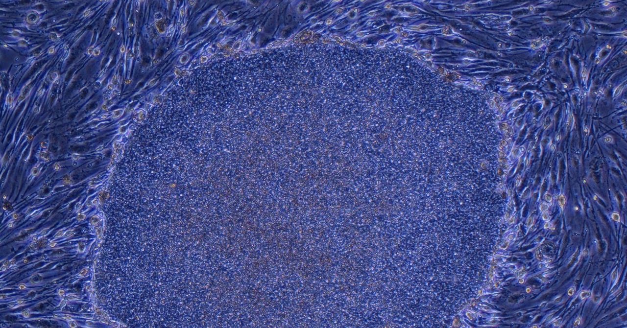 Japão aprova o primeiro tratamento do mundo feito com células humanas reprogramadas