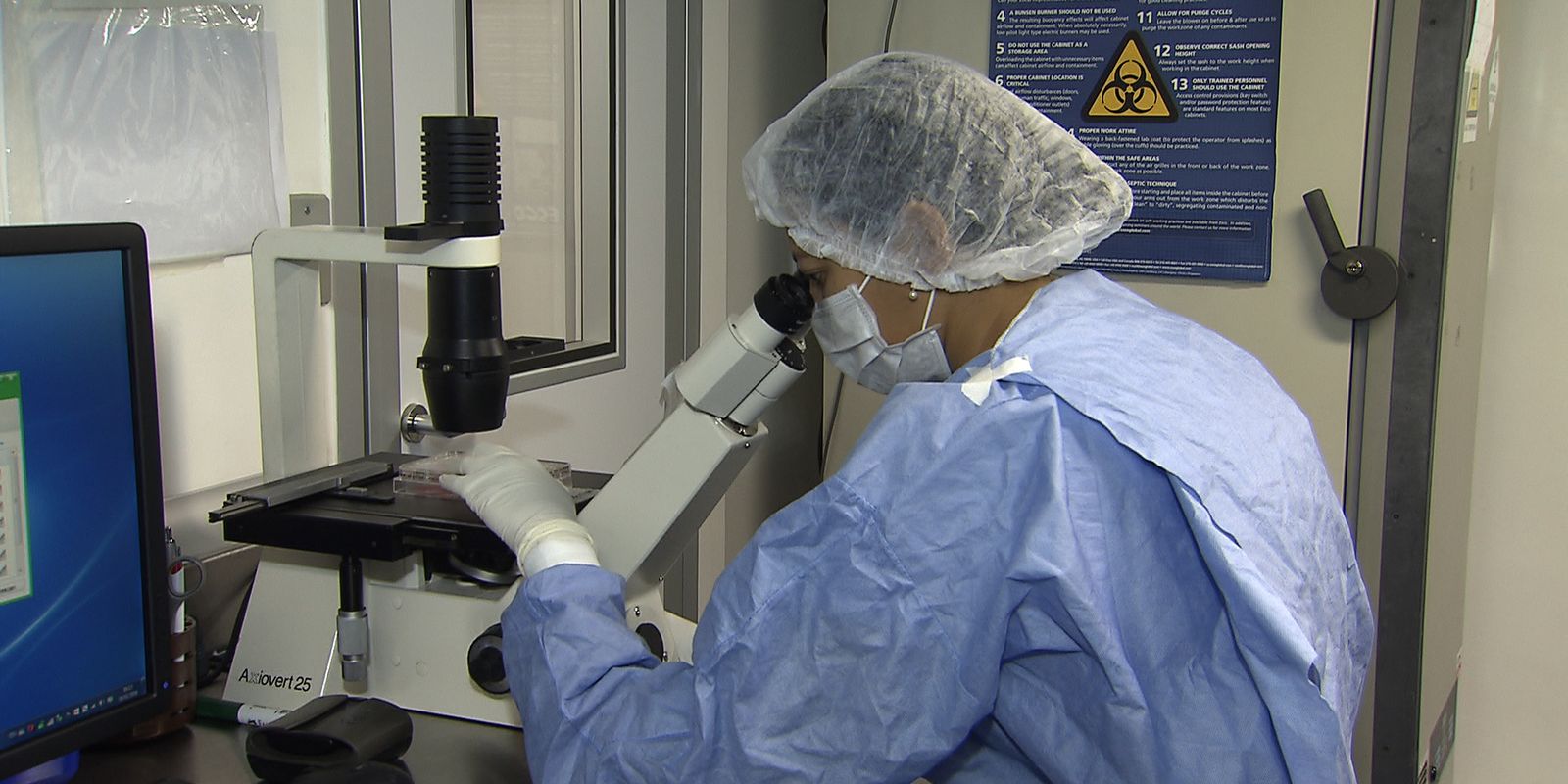 Como cientistas “curaram” infectados com HIV